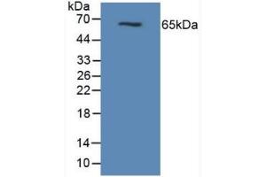 Figure. (MUC1 anticorps  (AA 474-630))