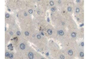 Detection of FUM in Human Liver Tissue using Polyclonal Antibody to Fumarase (FUM)