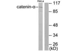 Western blot analysis of extracts from HeLa cells, using Catenin-alpha1 Antibody.