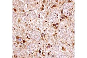 FGFR3 antibody immunohistochemistry analysis in formalin fixed and paraffin embedded mouse brain tissue. (FGFR3 anticorps  (AA 468-495))