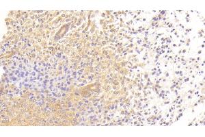 Detection of TGFbR3 in Mouse Uterus Tissue using Polyclonal Antibody to Transforming Growth Factor Beta Receptor III (TGFbR3) (TGFBR3 anticorps  (AA 469-724))