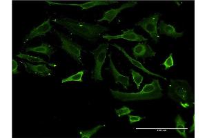 Immunofluorescence of monoclonal antibody to TSSK3 on HeLa cell.