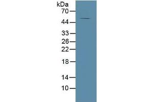 Rabbit Capture antibody from the kit in WB with Positive Control: Human tibia lysate. (MMP13 Kit CLIA)