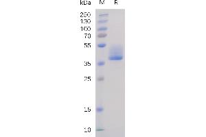 Human BAFF-R Protein, hFc Tag on SDS-PAGE under reducing condition.