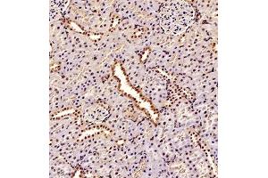 Immunohistochemistry of paraffin embedded rat kidney using TBCldl (ABIN7075843) at dilution of 1:2000 (200x lens)
