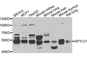 Western blot analysis of extracts of various cell lines, using SPTLC1 antibody (ABIN5974083) at 1/1000 dilution. (SPTLC1 anticorps)