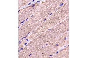 Antibody staining MYBPC3 in human skeletal muscle tissue sections by Immunohistochemistry (IHC-P - paraformaldehyde-fixed, paraffin-embedded sections).