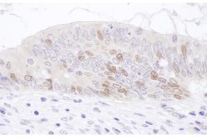 anti-PCNA Clamp Associated Factor (PAF) (AA 1-50) antibody