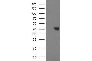 Western Blotting (WB) image for anti-Sulfotransferase Family, Cytosolic, 1C, Member 2 (SULT1C2) antibody (ABIN1501230) (SULT1C2 anticorps)