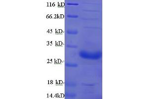 TOX1 (AA 35-269) protein (His tag)