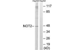 Western blot analysis of extracts from HepG2 cells, treated with starved 24h, using CNOT2 (Ab-101) Antibody.