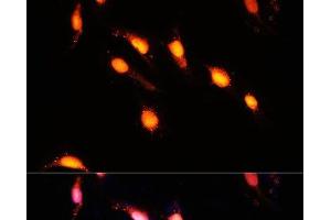 Immunofluorescence analysis of U-2 OS cells using GTF3C4 Polyclonal Antibody at dilution of 1:100 (40x lens). (GTF3C4 anticorps)