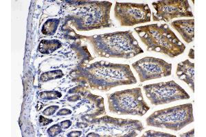 IHC analysis of CD151 using anti- CD151 antibody . (CD151 anticorps  (AA 113-175))