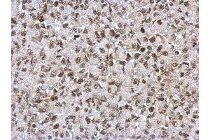 Image no. 1 for anti-Sin3A-Associated Protein, 130kDa (SAP130) (N-Term) antibody (ABIN1494118)