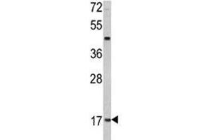 Western blot analysis of Leptin antibody MDA-MB231 lysate.