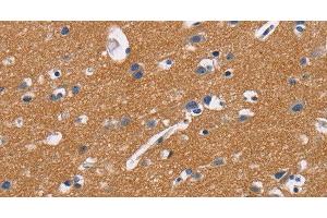 Immunohistochemistry of paraffin-embedded Human brain tissue using CD47 Polyclonal Antibody at dilution 1:50 (CD47 anticorps)