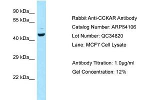 Western Blotting (WB) image for anti-Cholecystokinin A Receptor (CCKAR) (C-Term) antibody (ABIN2789733) (CCKAR anticorps  (C-Term))
