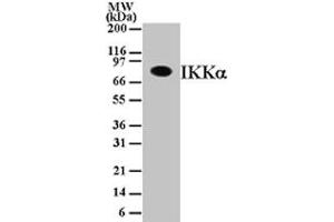 IKK alpha Western Blot. (IKK alpha anticorps)