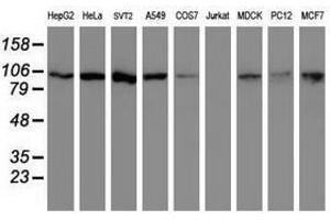 Image no. 2 for anti-Cullin 4B (CUL4B) (AA 1-300) antibody (ABIN1490726)