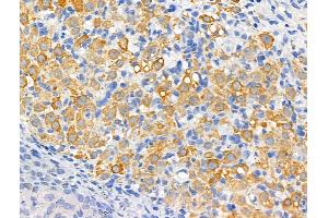 ABIN6261404 and ABIN6266530 at 1/100 staining Rat ovarian tissue by IHC-P.