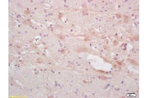 Formalin-fixed and paraffin embedded rat brain labeled with Rabbit Anti NF66/alpha Internexin Polyclonal Antibody, Unconjugated (ABIN739830) at 1:200 followed by conjugation to the secondary antibody and DAB staining (INA anticorps  (AA 251-350))