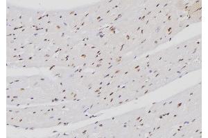 ABIN6274272 at 1/100 staining Mouse heart tissue by IHC-P.
