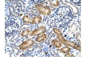 P2RX2 antibody was used for immunohistochemistry at a concentration of 4-8 ug/ml to stain Epithelial cells of renal tubule (arrows) in Human Kidney.