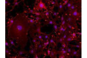 Immunofluorescence (IF) image for anti-CD44 (CD44) antibody (Alexa Fluor 594) (ABIN2656833) (CD44 anticorps  (Alexa Fluor 594))