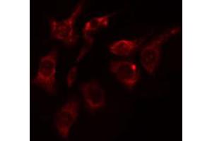 ABIN6274425 staining HepG2 cells by IF/ICC. (DCLK2 anticorps  (N-Term))