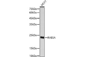 Western blot analysis of extracts of MCF7 cells, using RA antibody (ABIN3021646, ABIN3021647, ABIN3021648 and ABIN1513457) at 1:500 dilution. (RAB5 anticorps  (AA 1-215))