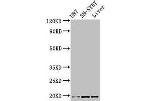 Western Blot Positive WB detected in: U87 whole cell lysate, SH-SY5Y whole cell lysate, Mouse liver tissue All lanes: TSLP antibody at 3. (Thymic Stromal Lymphopoietin anticorps  (AA 29-159))