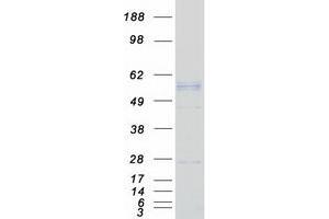 Validation with Western Blot