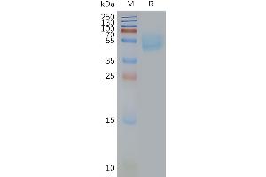 Adenosine A2a Receptor (ADORA2A) protein