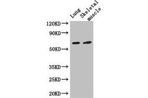 Western Blot Positive WB detected in: Mouse lung tissue, Mouse skeletal muscle tissue All lanes: PAK3 antibody at 3 μg/mL Secondary Goat polyclonal to rabbit IgG at 1/50000 dilution Predicted band size: 63, 61, 65 kDa Observed band size: 63 kDa