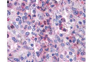 Immunohistochemistry (IHC) image for anti-serum/glucocorticoid Regulated Kinase Family, Member 3 (SGK3) (N-Term) antibody (ABIN2786285)