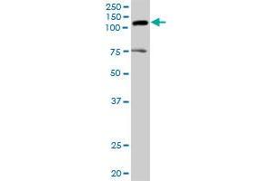 AXL MaxPab rabbit polyclonal antibody. (AXL anticorps  (AA 1-894))