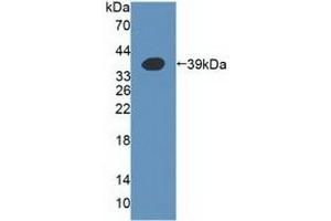 Detection of Recombinant a4GALT, Human using Polyclonal Antibody to Alpha-1,4-Galactosyltransferase (a4GALT)