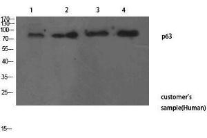 Western Blotting (WB) image for anti-T-Complex 1 (TCP1) (N-Term) antibody (ABIN3187722) (TCP1 alpha/CCTA anticorps  (N-Term))