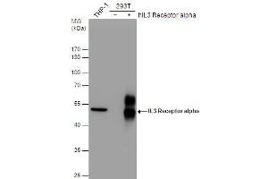 WB Image IL3 Receptor alpha antibody [N2C2], Internal detects IL3 Receptor alpha protein by western blot analysis. (IL3RA anticorps)