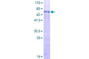 Image no. 1 for Ceramide Synthase 4 (CERS4) (AA 1-394) protein (GST tag) (ABIN1309175)