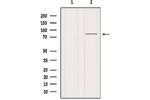Western blot analysis of extracts from Hela, using PI3-kinase p85-alpha Antibody.