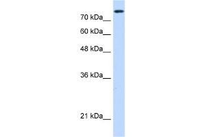 WB Suggested Anti-NCAPH Antibody Titration:  0. (NCAPH anticorps  (C-Term))