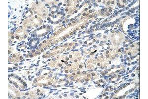 Image no. 1 for anti-Nucleus Accumbens Associated 1, BEN and BTB (POZ) Domain Containing (NACC1) (C-Term) antibody (ABIN202717)