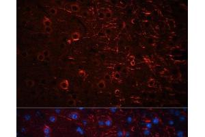 Immunofluorescence analysis of Mouse brain using Aquaporin 4 Polyclonal Antibody at dilution of 1:100 (40x lens). (Aquaporin 4 anticorps)
