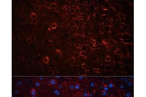 Immunofluorescence analysis of Mouse brain using Aquaporin 4 Polyclonal Antibody at dilution of 1:100 (40x lens).