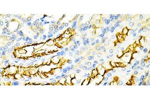 Immunohistochemistry of paraffin-embedded Mouse kidney using PPP2R4 Polyclonal Antibody at dilution of 1:200 (40x lens). (PPP2R4 anticorps)