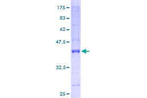 Image no. 1 for Glutaredoxin 2 (GRX2) (AA 1-124) protein (GST tag) (ABIN1355238)