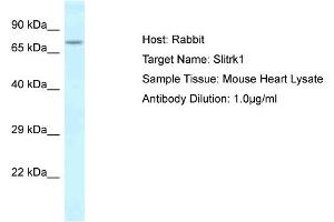 Host: Rabbit Target Name: Slitrk1 Sample Type: Mouse Heart lysates Antibody Dilution: 1. (SLITRK1 anticorps  (C-Term))