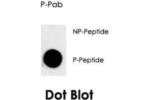 Dot blot analysis of CDK7 (phospho T170) polyclonal antibody  on nitrocellulose membrane.
