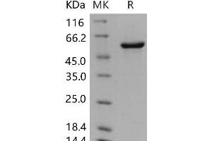 Prolyl 4-Hydroxylase, beta Polypeptide (P4HB) (Active) protein (His tag)